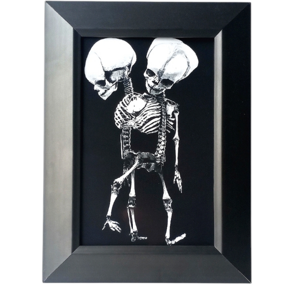 Conjoined Twins Sideshow FreakShow Oddity Freakshow Side Show Oddities Goth Art